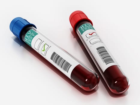 Positive and negative blood samples in vials with HIV test labels. 3D illustration.