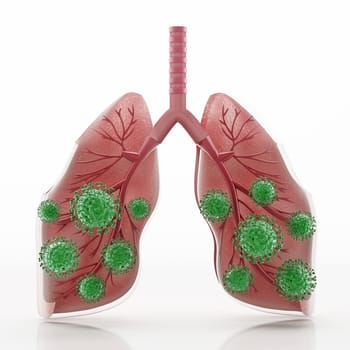 Green viruses around human lungs. 3D illustration.