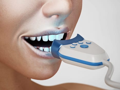 Teeth whitening treatment. 3D illustration.