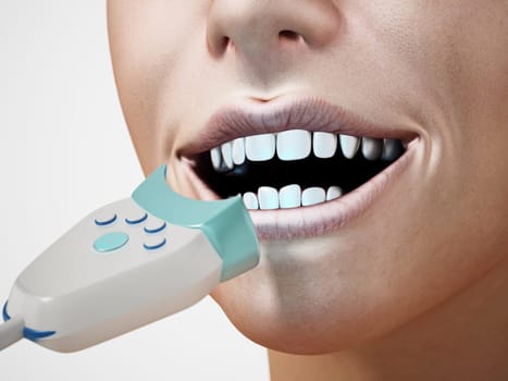Teeth whitening treatment. 3D illustration.