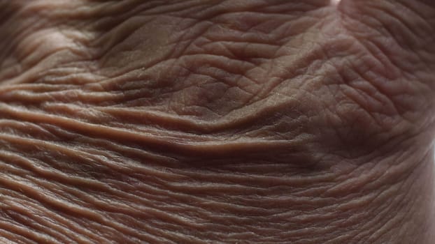 Close up of Senior's hands with Alzheimer disease