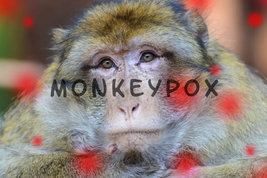 Monkeypox outbreak, MPXV virus, infectious disease spreading, sick monkey