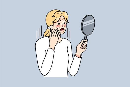 Distressed woman look in mirror worry about acne problems. Unhappy girl stress about pimples, having skincare troubles. Skin healthcare and dermatology. Vector illustration.