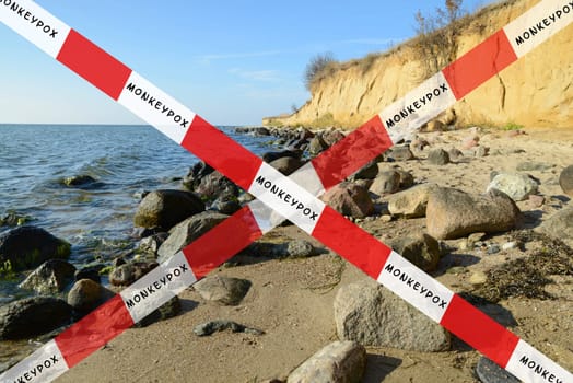 Closed travel destination due to monkeypox outbreak, the MPXV virus, infectious disease spreading, pandemic
