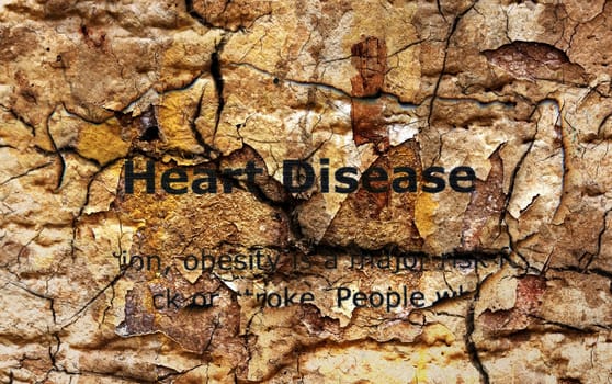 Heart disease