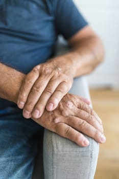 Elderly man suffering from psoriasis, closeup on hands