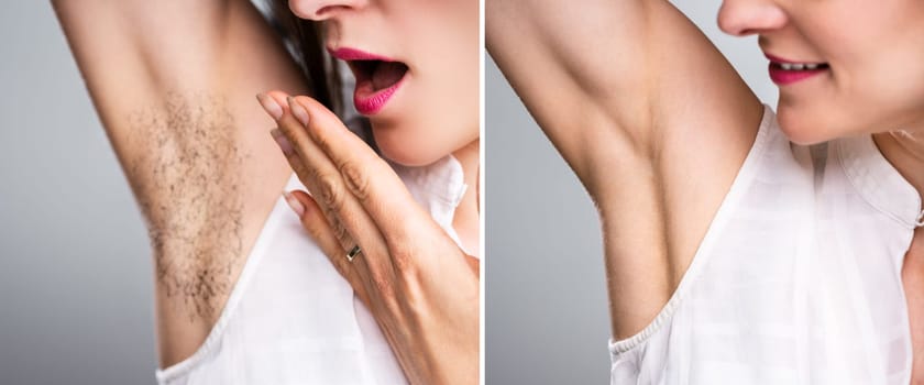 Before And After Concept Of Woman's Underarm Hair Removal On Grey Background