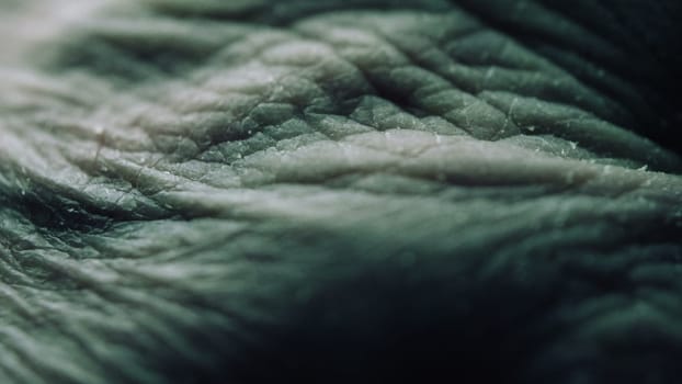 Close Up Of Senior's Hands With Alzheimer Disease
