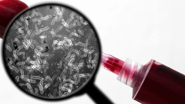 Searching for bacteria in blood,Searching for bacteria in blood