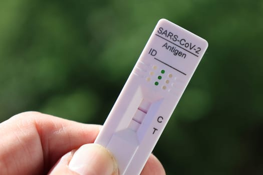 From 1 July 2022,corona tests will be chargeable for people in Germany. According to the decision of the Federal Government,3 euros per test must be paid at the test stations.