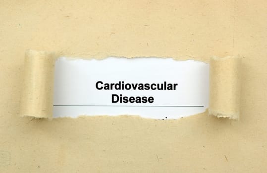 Cardiovascular disease