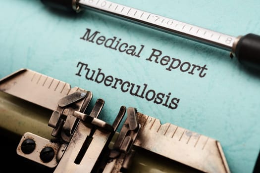 Tuberculosis