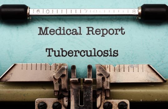 Tuberculosis
