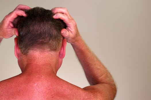 Close-up rear view of a shirtless adult caucasian man massaging with his hands his head that has brown hair. Upper body rear view of a mature white male massaging his scalp with his hands and fingers