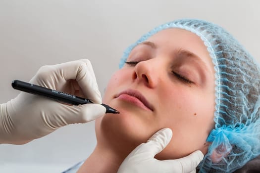 Dotor in gloves preparing young female for cosmetic surgery. Hands with marker pen drawing marks on lady face. Person holding pen over the skin befor plactic treatment.