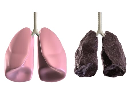 3d rendered anatomy illustration of a healthy and a bad lung