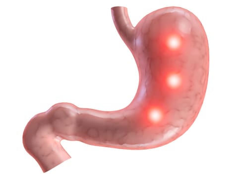 3d rendered anatomy illustration of a human stomach with pain
