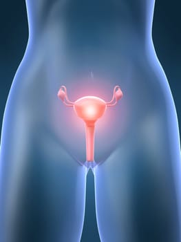 3d rendered anatomy illustration of a female shape with a painful uterus