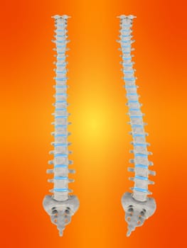 3d rendered anatomy illustration of a human spine with scoliosis
