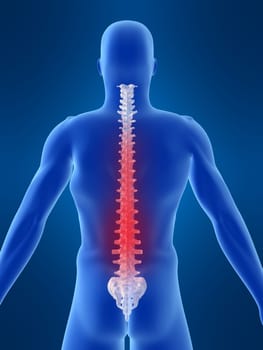 3d rendered anatomy illustration of a human skeleton with a painful spine
