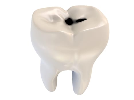 3d rendered illustration of a human tooth with caries