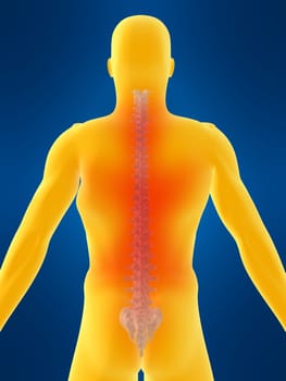 3d rendered anatomy illustration of a body shape with a painful spine