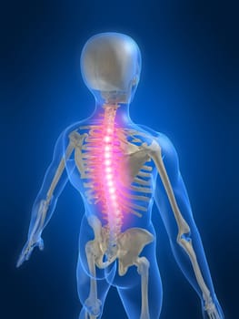 3d rendered anatomy illustration of a human skeleton with a painful spine