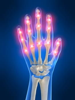 3d rendered anatomy illustration of a human skeletal hand with pain