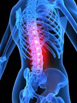 3d rendered anatomy illustration of a human skeleton with a painful spine