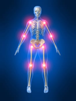 3d rendered anatomy illustration of a human skeleton with painful joints