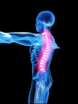 3d rendered anatomy illustration of a human skeleton with a painful spine