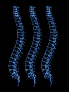 3d x-ray illustration of three human spines