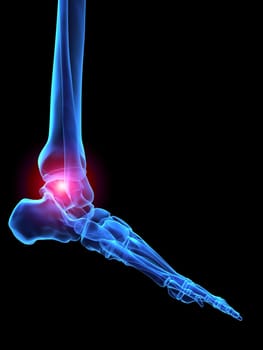 3d rendered x-ray illustration of a human skeletal foot with pain