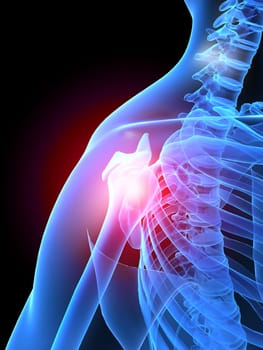 3d rendered x-ray illustration of human painful shoulders