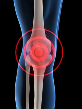 3d rendered anatomy illustration of a human skeletal knee with pain