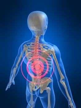 3d rendered anatomy illustration of a human skeleton with a painful spine