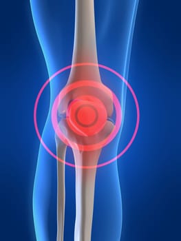 3d rendered anatomy illustration of a painful human knee