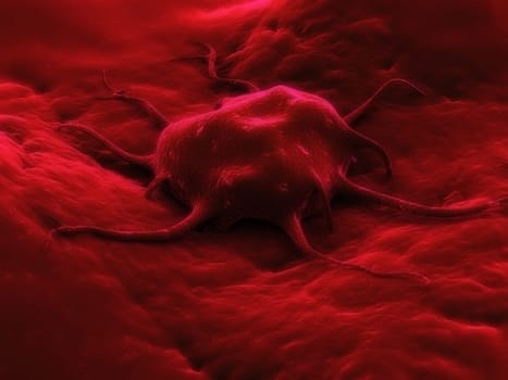 3d rendered illustration of a cancer cell