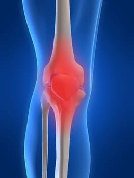 3d rendered anatomy illustration of a human skeletal knee with pain
