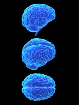 3d rendered anatomy illustration of different signs of a human brain