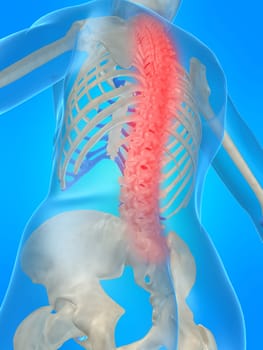 3d rendered anatomy illustration of a human skeleton with a painful spine