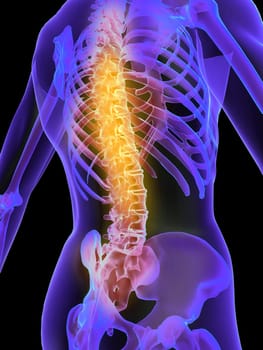3d rendered anatomy illustration of a human skeleton with a painful spine