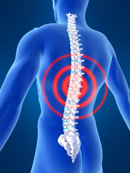 3d rendered anatomy illustration of a human skeleton with a painful spine