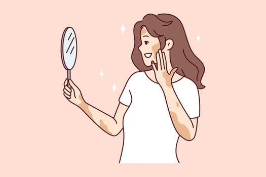 Smiling woman with vitiligo look in mirror feeling body positive. Happy girl with skin disease feel satisfied and optimistic. Skincare and dermatology. Vector illustration.