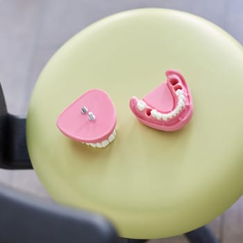 Aesthetic dentistry. Close-up of pink gypsum dental model of human teeth that doctor will present to patient. Top view of jaw model without several teeth lying on green table.