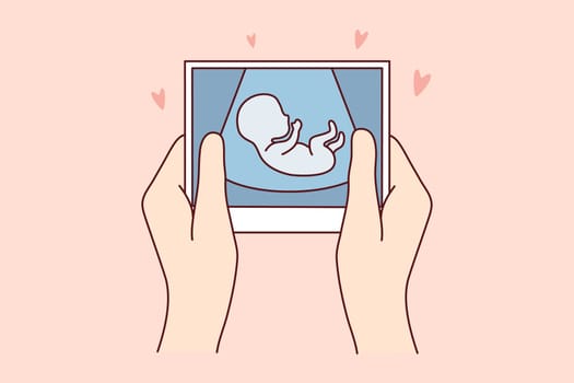 Hands of person holding scan of embryo waiting for baby birth. Future mother with ultrasound picture of baby. Motherhood concept. Vector illustration.