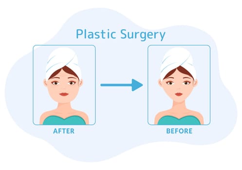 Plastic Surgery Flat Cartoon Hand Drawn Templates Illustration of Medical Surgical Operation on the Body or Face as Expected using Advanced Equipment