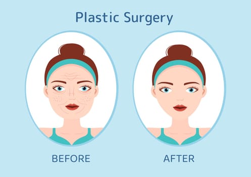 Plastic Surgery Flat Cartoon Hand Drawn Templates Illustration of Medical Surgical Operation on the Body or Face as Expected using Advanced Equipment