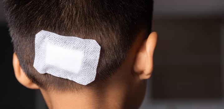 The lacerated suture wound of kid back head which suture with trauma the head by medical bandage, Medical care of the surgery lesion on the head, children of Accident