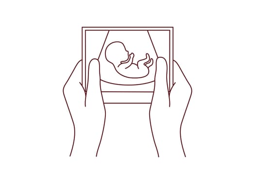 Hands of person holding scan of embryo waiting for baby birth. Future mother with ultrasound picture of baby. Motherhood concept. Vector illustration.